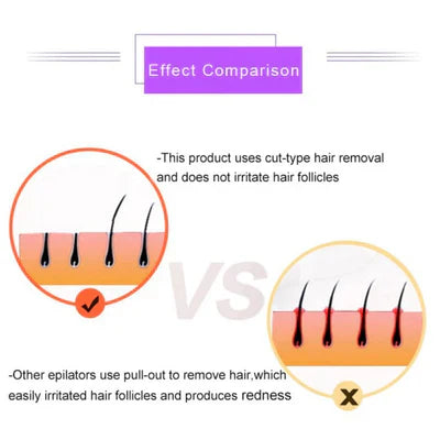 𝐇𝐨𝐦𝐞𝐞𝐚𝐬𝐞 ™Purple Epilator – آلة إزالة الشعر البنفسجية Auraé