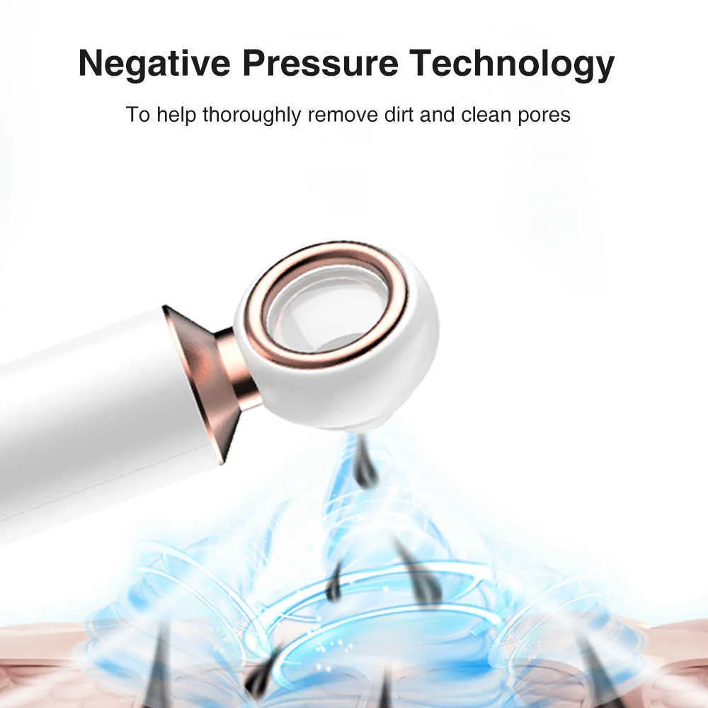 𝐇𝐨𝐦𝐞𝐞𝐚𝐬𝐞 ™ Blackhead Suction Machine Auraé