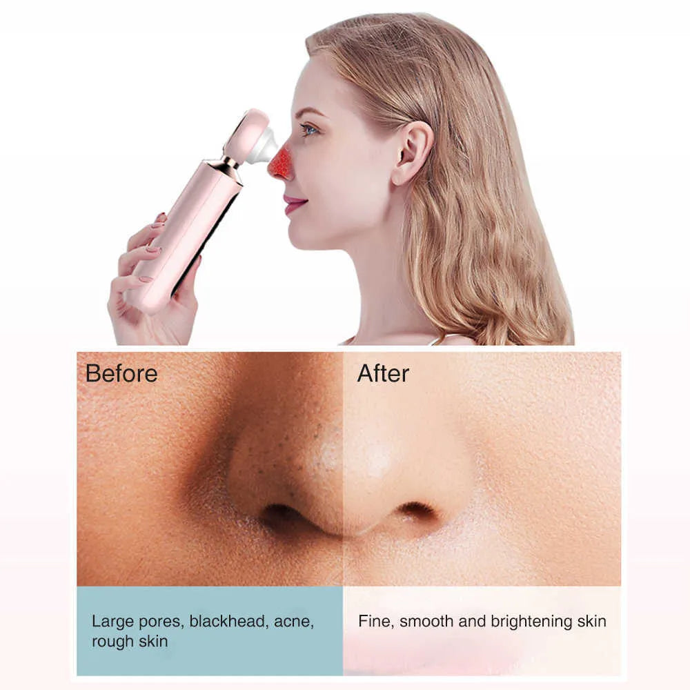 𝐇𝐨𝐦𝐞𝐞𝐚𝐬𝐞 ™ Blackhead Suction Machine Auraé