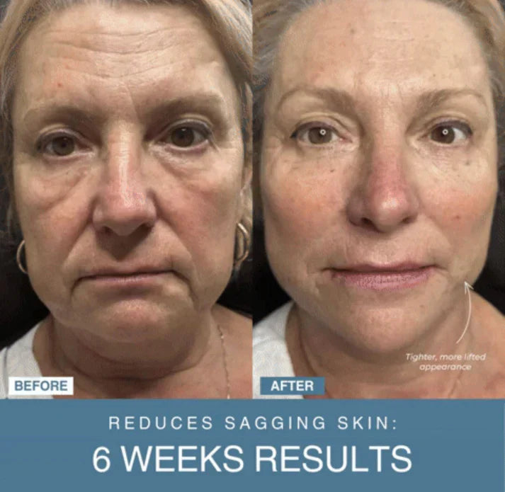 𝐇𝐨𝐦𝐞𝐞𝐚𝐬𝐞™ 7-in-1 LED Anti-Aging/Wrinkle Apparatus Auraé