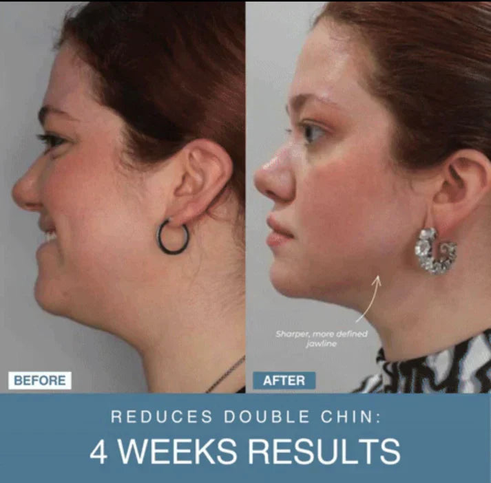 𝐇𝐨𝐦𝐞𝐞𝐚𝐬𝐞™ 7-in-1 LED Anti-Aging/Wrinkle Apparatus Auraé