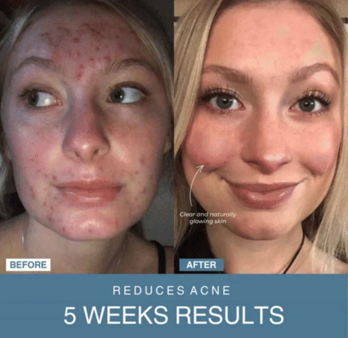 𝐇𝐨𝐦𝐞𝐞𝐚𝐬𝐞™ 7-in-1 LED Anti-Aging/Wrinkle Apparatus Auraé