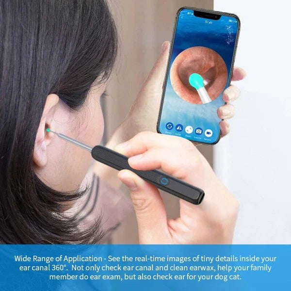 Vivenza ™Smart Ear Cleaning Device Vivenza