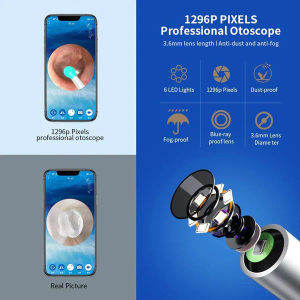 Vivenza ™Smart Ear Cleaning Device Vivenza