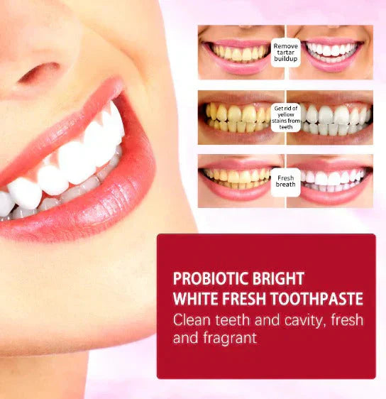 𝐇𝐨𝐦𝐞𝐞𝐚𝐬𝐞™Sp-4 Toothpaste Auraé
