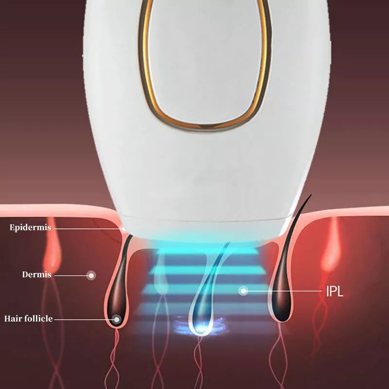 𝐇𝐨𝐦𝐞𝐞𝐚𝐬𝐞 ™ IPL Laser Hair Removal – جهاز إزالة الشعر بالليزر IPL Auraé